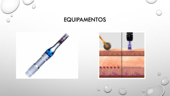 Curso Microagulhamento Syma Instituto