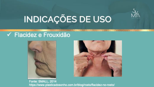 Curso Peelings Avançados Syma Instituto