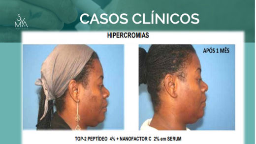 Curso Prescrição Drug Delivery Syma Instituto