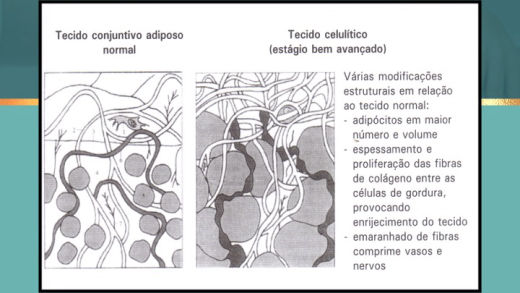 Curso Prescrição Emagrecimento Syma Instituto