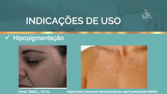 Curso Peelings Magistrais Syma Instituto