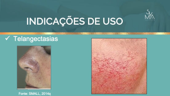 Curso Peelings Magistrais Syma Instituto
