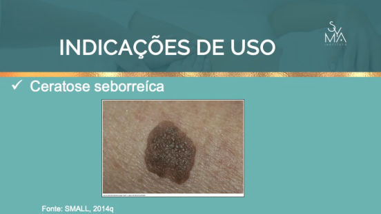 Curso Peelings Magistrais Syma Instituto