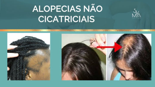 Curso Terapia Capilar Syma Instituto